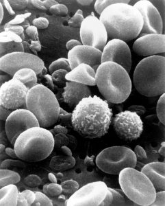 a scanning electron microscope image from normal circulating human blood. One can see red blood cells, several white blood cells including lymphocytes, a monocyte, a neutrophil, and many small disc-shaped platelets.