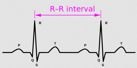 A section of an ECG showing the R-R interval - the time between heart beats. HRV measures the variation in this interval. This measurement gives an indication of health in Long Covid.